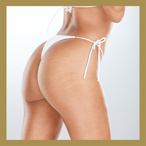 
            
                Load image into Gallery viewer, Model - Non Surgical Butt Lift BBL (150ml)
            
        