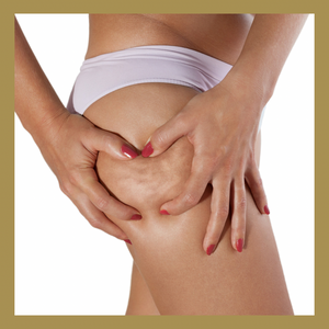 Cellulite Injections (Alidya) 5 Sessions